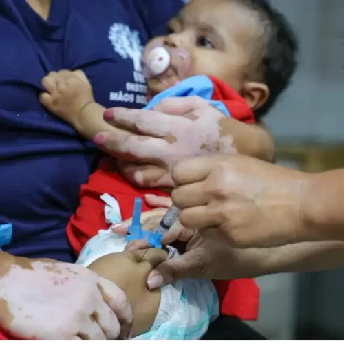 Casos de coqueluche em crianças aumentam mais de 1.200% no Brasil em 2024