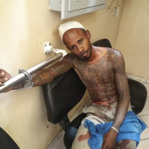 Polícia prende acusado de praticar estupros em diversos bairros de Feira de Santana