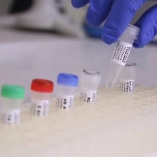 41 casos de COVID-19 são confirmados na Bahia