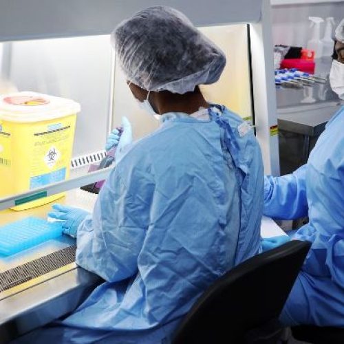 Covid-19: Fiocruz amplia capacidade nacional de testagem
