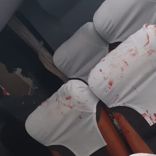 Bomba explode dentro de ônibus do Bahia; goleiro fica ferido