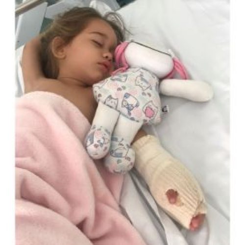 Criança prende a mão em escada rolante em Feira de Santana e passa por cirurgia