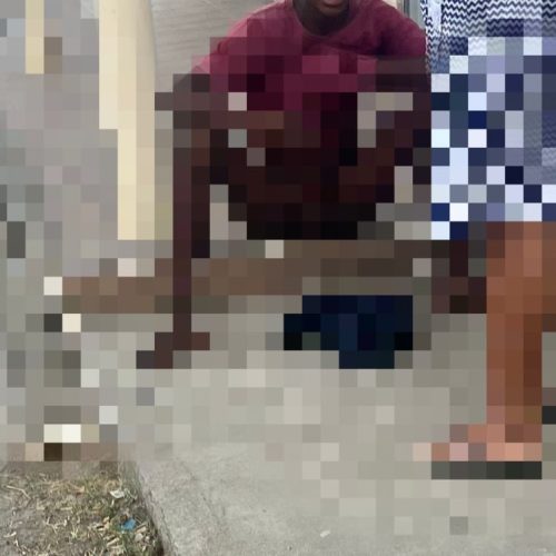 Adolescente é atacado por pitbull e sofre lacerações no pênis em Santaluz