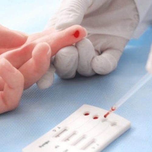 Fiocruz lança estudo inédito para ampliar prevenção ao HIV 