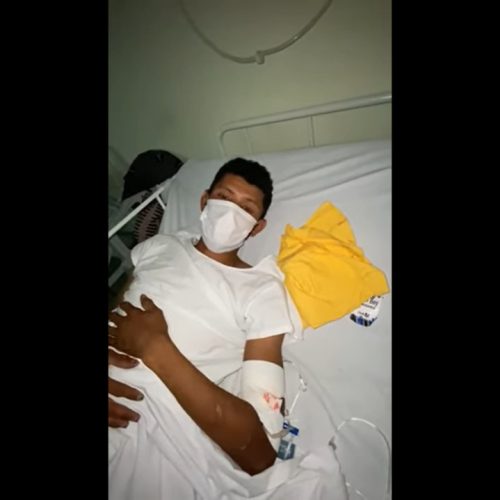 Malabarista baleado em Riachão, passa por cirurgia e faz vídeo agradecendo o apoio recebido: ‘Quero ficar bem logo’