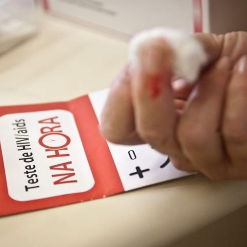 Aids: casos e óbitos caem 16% nos últimos quatro anos no Brasil