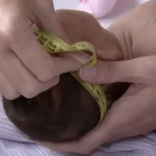 Governo regulamenta pagamento de indenização e pensão a vítimas da síndrome congênita do vírus Zika