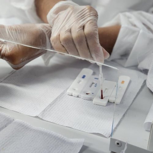 Sesab desmente boato sobre surto de HIV entre jovens na Bahia