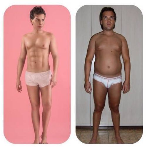 Médico alerta que nariz de “Ken Humano” pode cair com nova cirurgia