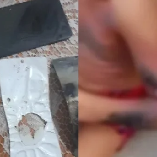 Garoto de 6 anos acaba com corpo queimado após celular explodir enquanto jogava