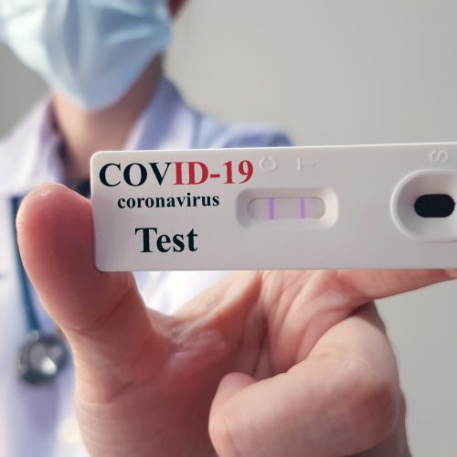COVID19 test  for diagnosis new corona virus
